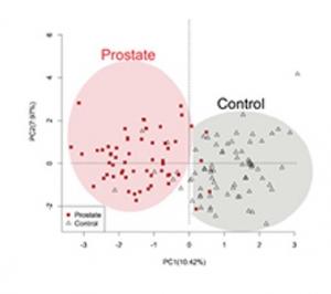 CANCER de la PROSTATE: Odoreader, le test qui le détecte dans les urines – Journal of Breath Research