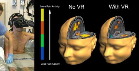 La réalité virtuelle devient thérapie anti-douleur