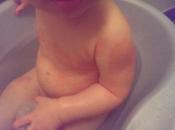 Bébé peau atopique…