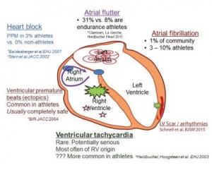 EXERCICE INTENSIF: Les effets cardiotoxiques possibles – Canadian Journal of Cardiology