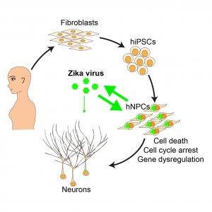 ZIKA et microcéphalie: Le lien biologique et le processus décryptés – Cell Stem Cell
