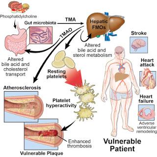 #Cell #TMAO microbesintestinaux #plaquettes #thrombose Le métabolite microbien intestinal TMAO augmente l’hyperréactivité plaquettaire et le risque de thrombose