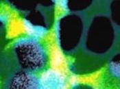 ALZHEIMER: rôle critique neuro-inflammation AP-HP Brain