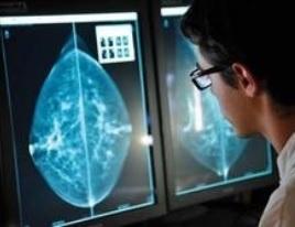 CANCER du SEIN: Le gène qui alcoolisé déclenche le risque  – PLoS ONE