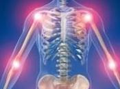 ARTHROSE: L'inefficacité paracétamol nouveau démontrée Lancet