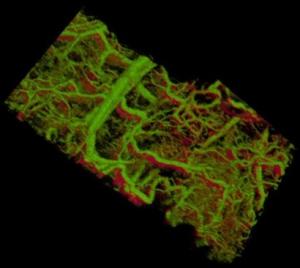 CANCER: Pouvoir observer en 3D les cellules et les tissus sous la peau – Stanford