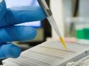 CANCER SEIN: Identification d'un nouveau gène facteur indicateur précoce American Journal Pathology