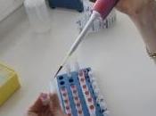 VIH-Sida: Oyi, candidat vaccin prometteur testé Marseille Retrovirology