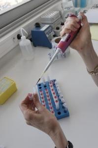 VIH-Sida: Tat Oyi, le candidat vaccin prometteur testé à Marseille – Retrovirology
