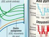 #thelancetneurololgy #α-synucléine #troubledusommeil #maladiedeparkinson #glandesousmaxillaire Étude l’α-synucléine dans glandes sous-maxillaires patients atteints trouble sommeil mouvements oculaires rapides idiopathique