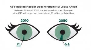 DMLA: Trop de graisse dans le sang, et les photorécepteurs disjonctent – Nature Medicine