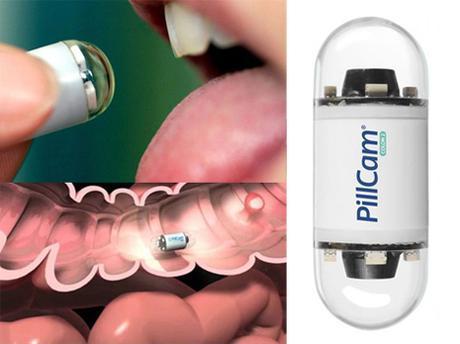 La pilule-caméra PillCam... ou l'assassin tant attendu de la coloscopie