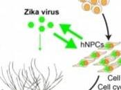 ZIKA MICROCÉPHALIE: Comment virus ronge cerveau Science