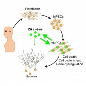 ZIKA et MICROCÉPHALIE: Comment le virus ronge le cerveau – Science