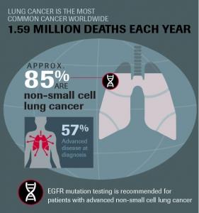 CANCER du POUMON: 30% du monde privés de tests ou de traitements – European Respiratory Journal