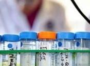 CHOLESTÉROL: Plus besoin jeuner avant test? European Heart Journal