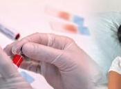 CANCER POUMON: Lyon, test sanguin remplace biopsie Hospices Civils Lyon Réseau