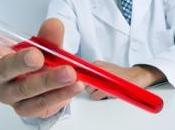 CANCER PROSTATE: IsoPSA, nouveau test identifie tumeurs bénignes Meeting American Geriatrics Society (AGS)