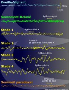 Le SOMMEIL paradoxal indispensable à la mémoire spatiale – Science