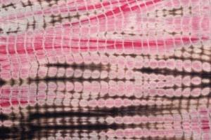 INGÉNIERIE TISSULAIRE: Produire du tissu humain avec les techniques du textile – Biomedical Materials