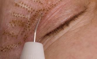 Ma seconde séance de Plexr pour un regard plus ouvert