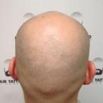 BEAUTE : Hair Tattoo by Hugues ou la micropigmentation capillaire