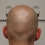 BEAUTE : Hair Tattoo by Hugues ou la micropigmentation capillaire