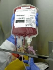 TRANSFUSION: Mieux préserver les globules, éliminer les effets indésirables – Canadian Blood Service et Vox Sanguinis