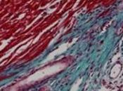 CRISE CARDIAQUE: nouveau-né détient régénération cardiaque Journal Cell Biology
