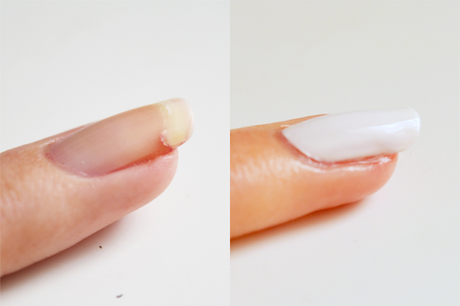 Réparer un ongle cassé avant après