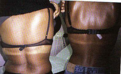 Peaux Noires – Peaux foncées – Peaux mates Des aspects spécifiques Dr