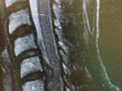 Escalade: saison terminée pour Alex Puccio