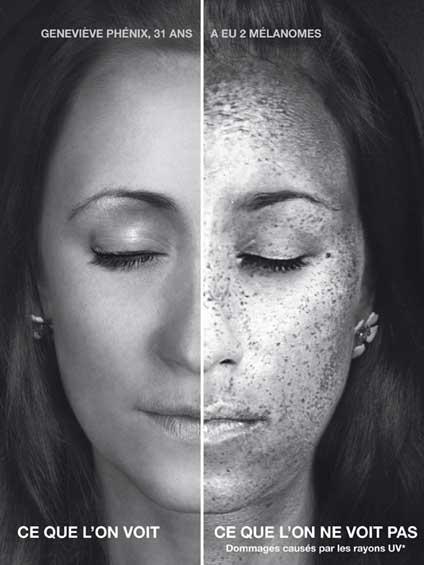 Bronzer quand on a la peau très claire, est ce impossible ?
