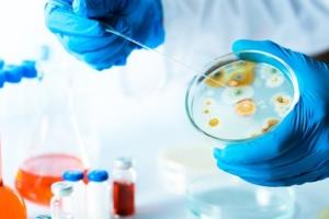 CANCER du SEIN: La piste des probiotiques pour protéger le sein – Applied and Environmental Microbiology