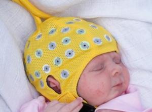 GROSSESSE: Les antidépresseurs affectent aussi l'activité cérébrale du bébé – Cerebral Cortex