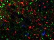 TOC: médicaments action rapide contre obsessions compulsives Biological Psychiatry
