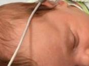 AUTISME: test d'audition pour détecter chez nouveau-nés? Autism Research