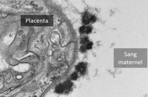 GROSSESSE et POLLUTION: Les microparticules traversent le placenta – Particle and Fibre Toxicology