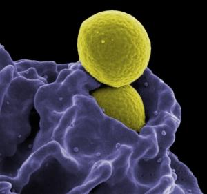 INFECTION des PLAIES: Evitons aux bactéries de trop s'attacher aux cellules  – PLoS ONE