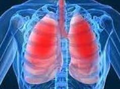 ASTHME SÉVÈRE: La nouvelle pilule qui réduit les symptômes – The Lancet Respiratory Medicine