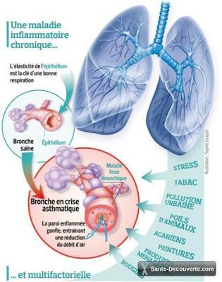 #thelancet #asthmesévère #benralizumab #éosinophilie #agonisteβ2 Efficacité et sécurité du benralizumab chez des patients atteints d’asthme sévère non contrôlé par l’inhalation de corticostéroïdes et les agonistes β2 à longue durée d’action (SIROCCO) :...