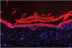 ULCÈRE DIABÉTIQUE: Le gel thermosensible qui cicatrise 4 fois plus vite – Journal of Controlled Release