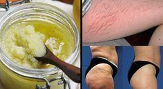 Epilation à la cire chaude  Doctissimo