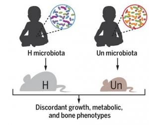 MICROBIOTE INTESTINAL: Une clé contre la malnutrition? – Science