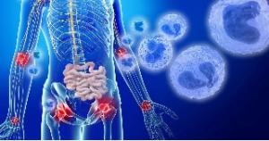 OTULIPÉNIE: La découverte d'une maladie inflammatoire qui touche les jeunes enfants – NHGRI et PNAS