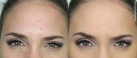 Peau grasse  Mademoiselle bio, 15 peaux grasses bio à partir de 7,55 euros.