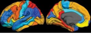 TAU PET: L'imagerie qui repousse les frontières dans la compréhension de l'Alzheimer  – Brain