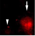 PARKINSON: Le virus cérébral qui fait passer la maladie – Science