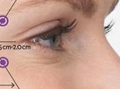 RAJEUNISSEMENT VISAGE: Toxine botulique, tout dans technique Plastic Reconstructive Surgery
