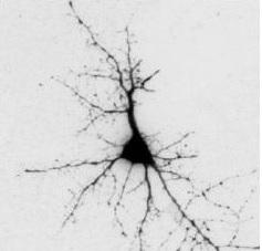 MICROBIOTE INTESTINAL: Il influence aussi la neurodégénérescence  – Scientific Reports